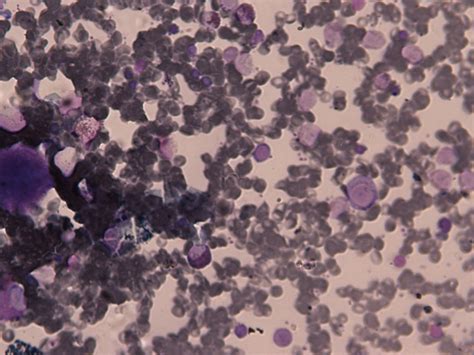 Haematology Watch