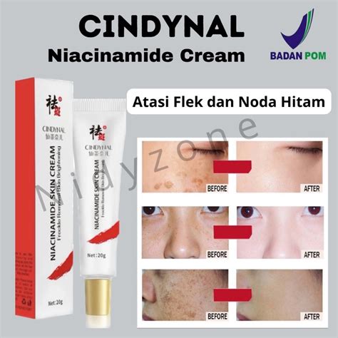 Jual Cindynal Cream Penghilang Flek Hitam Niacinamide Skin Cream Bpom