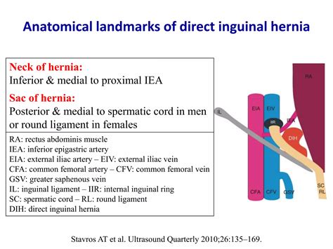 Ultrasound Of Groin Anterior Abdominal Wall Hernias PPT