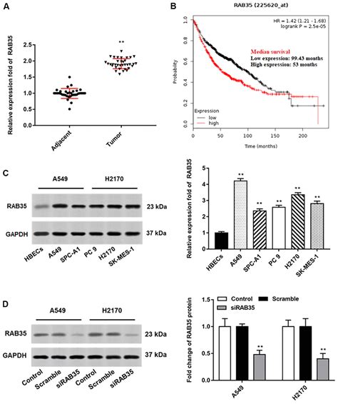 Mir P Targets Rab Gene To Regulate Tumor Cell Derived Exosomes