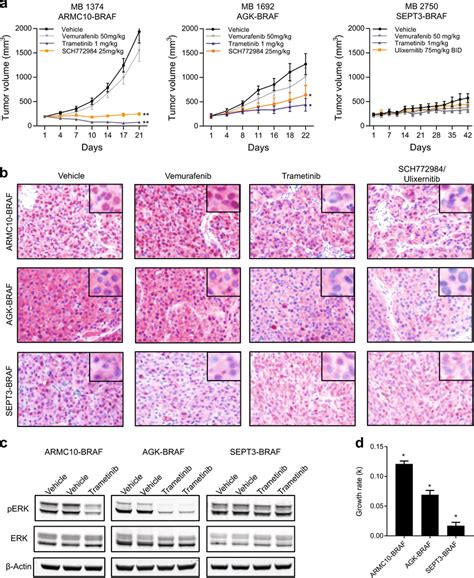 BRAF Fusion PDX Models Show Variable Response To MAPK Inhibitors A PDX