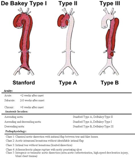 Thoracic Aortic Aneurysm Classification