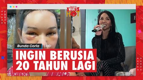 Bunda Corla Selesai Jalani Operasi Plastik Ingin Terlihat Seperti