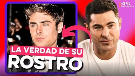 Qu Le Pas Al Rostro De Zac Efron Acentotv