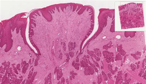 Oral Cavity And Salivary Glands Histology