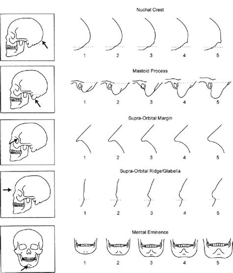 Figure 1 From Sexing Skulls Using Discriminant Function Analysis Of