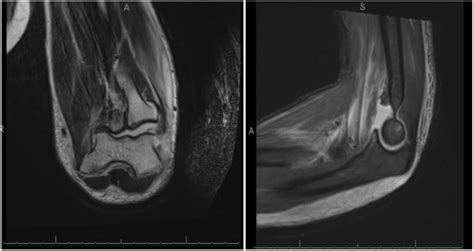 Magnetic Resonance Imaging With Contrast Download Scientific Diagram