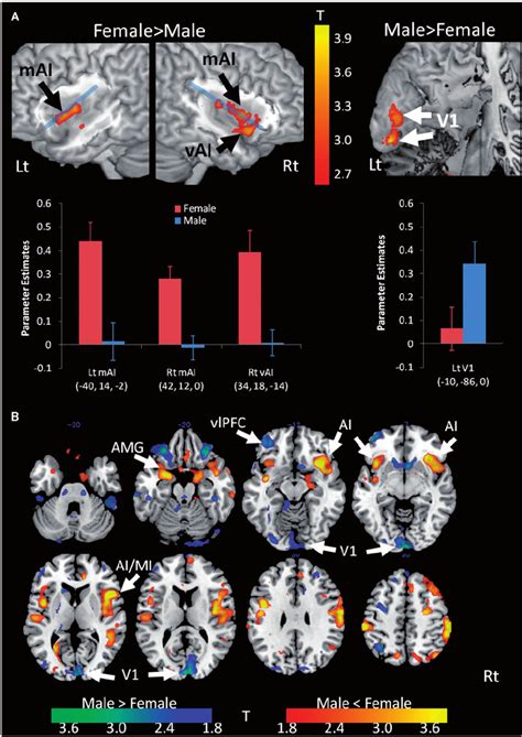 Sex Differences In The Association Between Neural Responses And Download Scientific Diagram