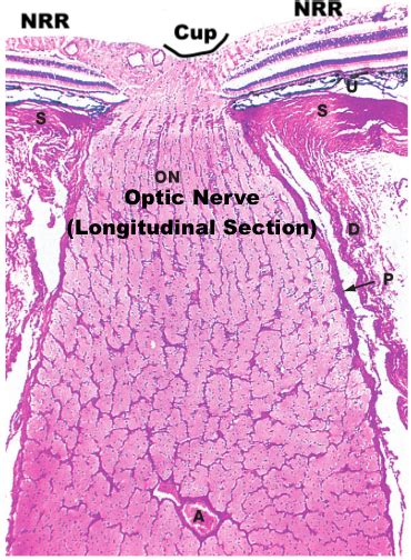 Normal Nerve Histology