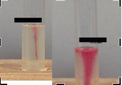 Lab Practical Ii Microbiology Flashcards Quizlet