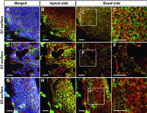 Immunofluorescence Staining Of Paxillin Green And F Actin Red