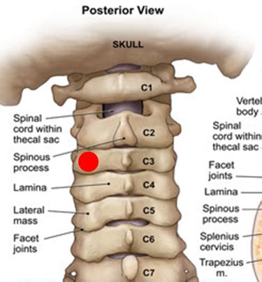 Cp Lecture Quiz Cervical Spine Flashcards Quizlet