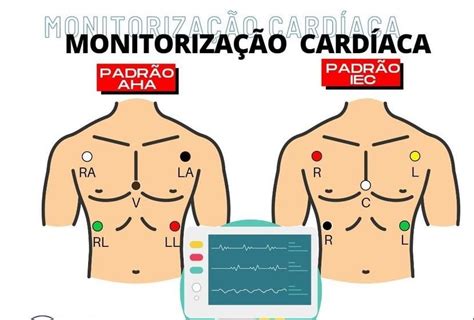 O Sistema de Monitorização Cardíaca 5 eletrodos provém de 2 TIPOS