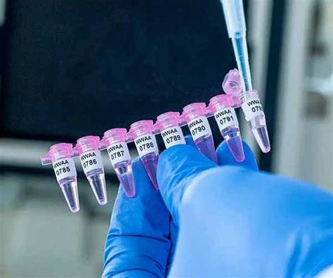 Adhesive Cryogenic Labels For PCR Tubes – Ruilabels