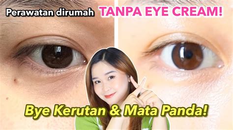 Cara Mengatasi Mata Panda Kerutan Tanpa Eye Cream Di Rumah Youtube