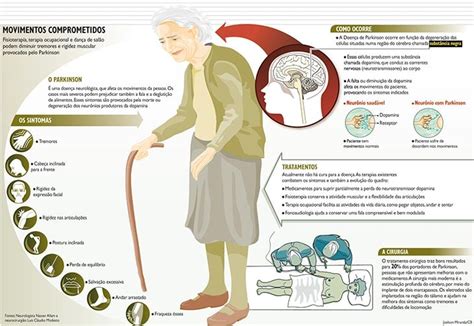O Que A Doen A De Parkinson Juiz De Fora Mg