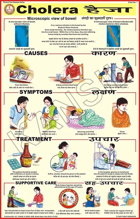 Full Color Laminated Paper Cholera For Prevent Diseases Chart At Rs 78