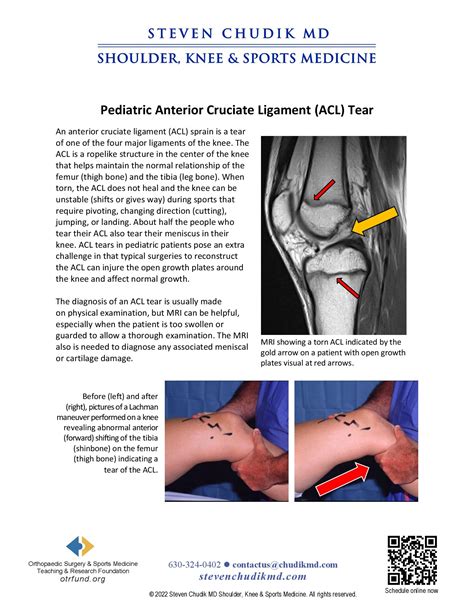 Pediatric Anterior Cruciate Ligament Acl Injuries Steven Chudik Md