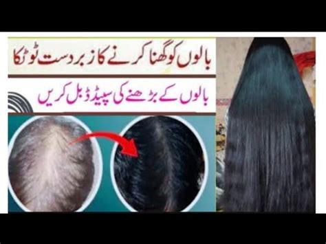 Hair Growth Oil Remedy By Zaini Balo Ko Lamba Or Mazboot Karne Ka