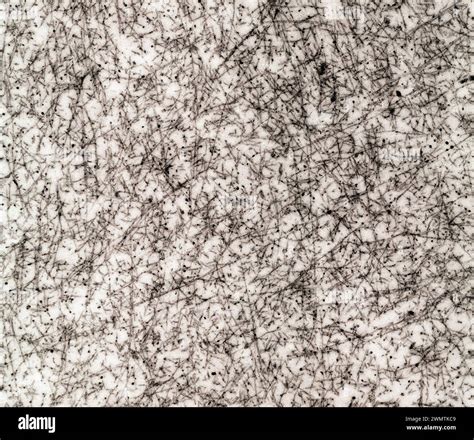 Hyaline Cartilage Matrix Ultrastructure Tem Stock Photo Alamy