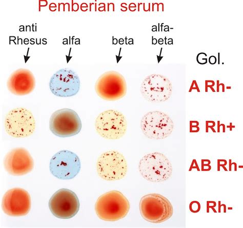 Uji Golongan Darah Biologipedia