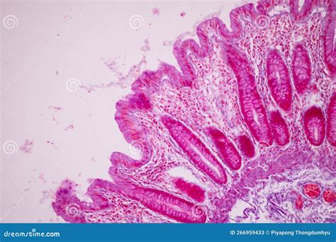 Tessuto Dell Intestino Tenue Duodeno Intestino Crasso Umano E Gastrico