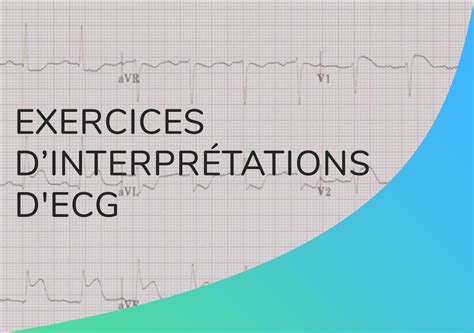 Exercice Dinterpr Tation D Ecg Qmed