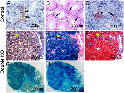 Reprogramming Of Sertoli Cells To Fetal Like Leydig Cells By Wt