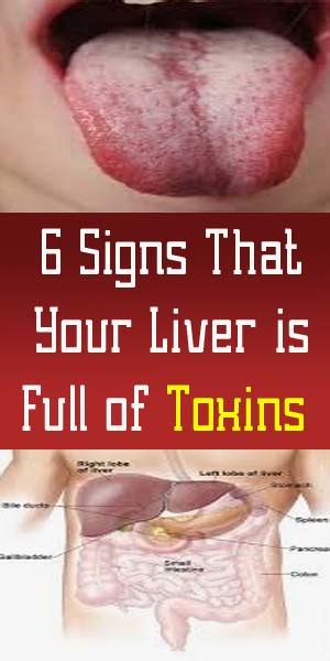 6 Signs That Your Liver Is Full Of Toxins