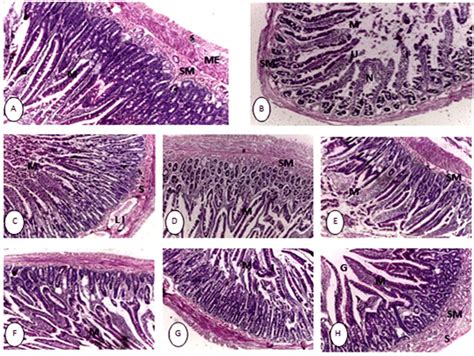 Histological Analysis Of Duodenal Mucosa Of Control And Experimental