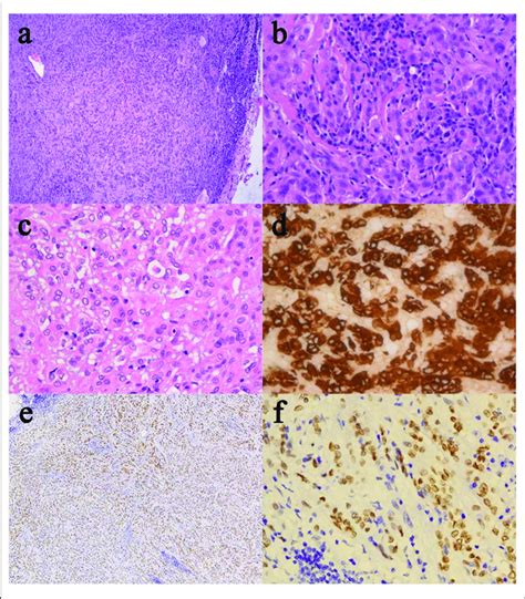 Histological And Immunohistochemical Features Of Cg A Clusters And