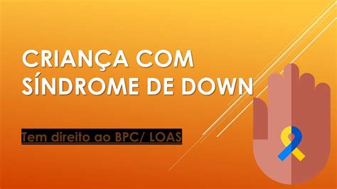 Concess O De Bpc Loas Para Crian A S Ndrome De Down Youtube