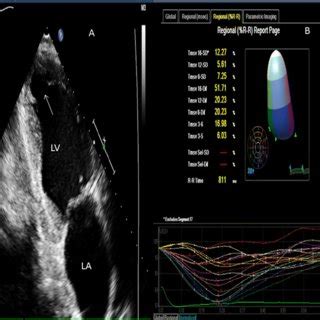 Chagas’ Disease: Update on Current Diagnosis | Request PDF 