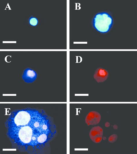 Morphology Of Irradiated Fl 4 Cells Cells Irradiated With 15 Gy Of γ