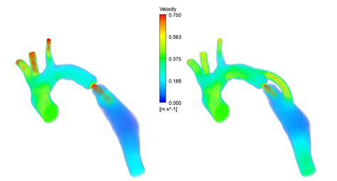 Série Explorando as doenças cardiovasculares por simulações