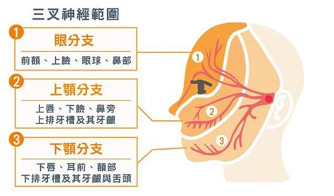 三叉神經痛，痛起來要人命，是牙疼和生產痛的加強版 每日頭條