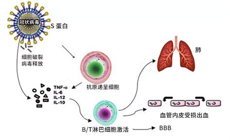 新冠靶点新视角之一：细胞因子风暴患者