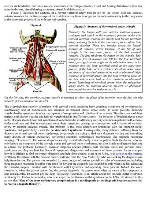 Thoracic Outlet Syndrome Anatomy Symptoms Diagnostic Evaluation And