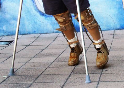 Flying With A Leg Brace What Do You Need To Know