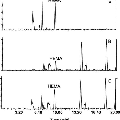 A Typical Total Ion Mass Chromatogram Of A Urine Sample Spiked At 4 Download Scientific Diagram