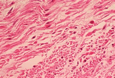 Basic Histology Smooth Muscle Longitudinal And Cross Sections