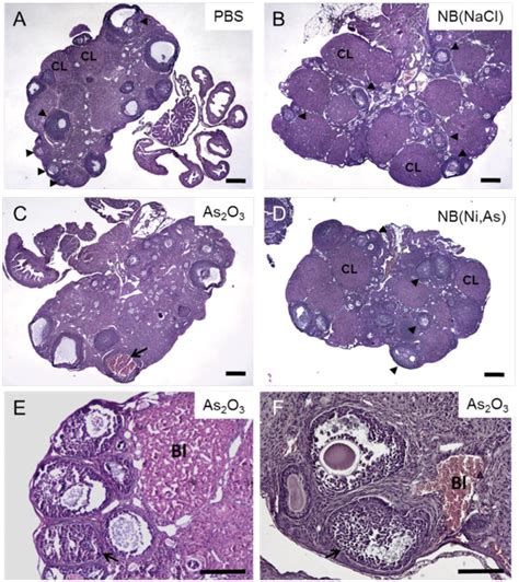 Hematoxylin And Eosin Staining Of Ovarian Sections From Mice Following