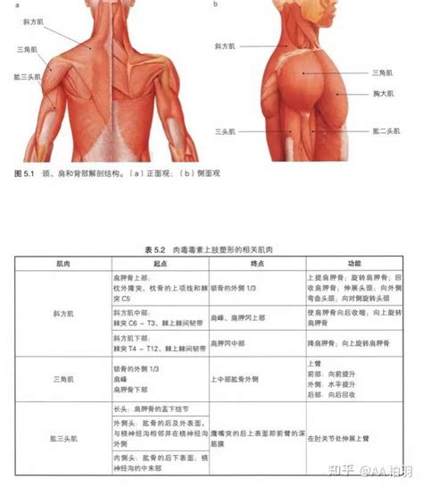 瘦肩针（斜方肌塑形）的注射方法 知乎