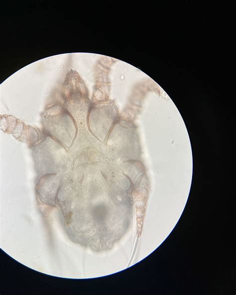 Scabies Hearts Pest Management