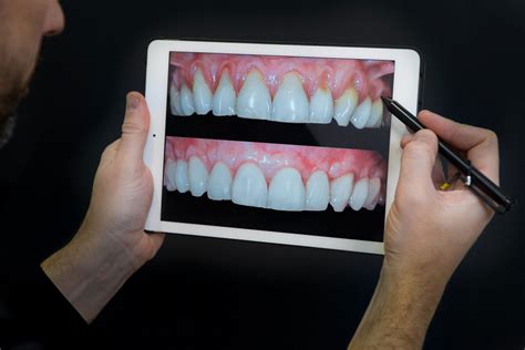 Digital Smile Design A Filosofia Revolucionária Da Medicina Dentária