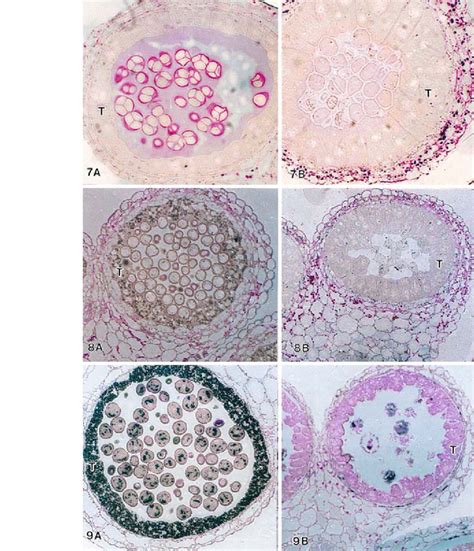 7. Meiosis. a Fertile anther with polysaccharide and starch stained ...