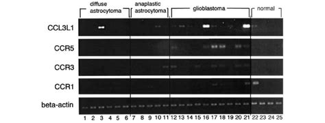 Rt Pcr Analysis Showing Expression Of Mrna Of Ccl3l1 Ccr1 Ccr3 And