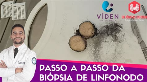 Como é feita a biopsia de linfonodo processamento do material pelo