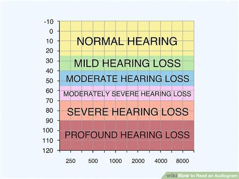 How To Read An Audiogram 15 Steps With Pictures Wikihow