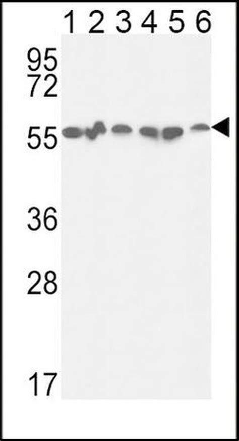 GPI Antibody PA5 26787